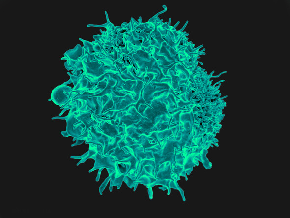 Scanning electron micrograph of a T cell