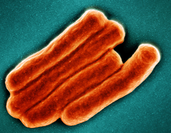 SEM of TB Bacteria