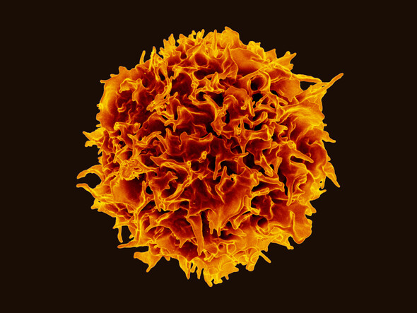 Colorized scanning electron micrograph of a CD4+ T-cell