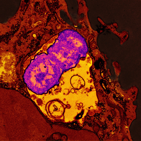 mbio K pneumoniae