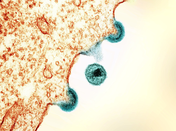 Transmission electron micrograph of HIV-1 virus particles from infected H9 cells, produced in cell culture. Credit: NIAID