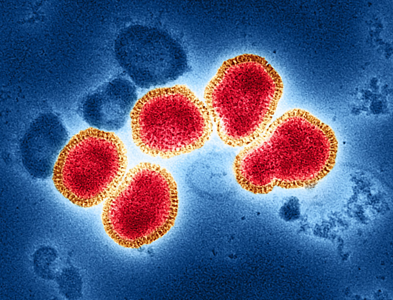 influenza virus particles