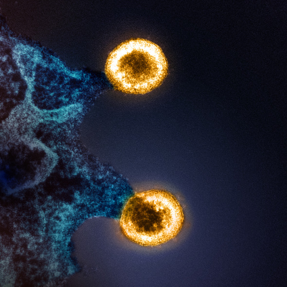 Black and dark blue granulated wavy matter with two light yellow spheres budding off to the right.