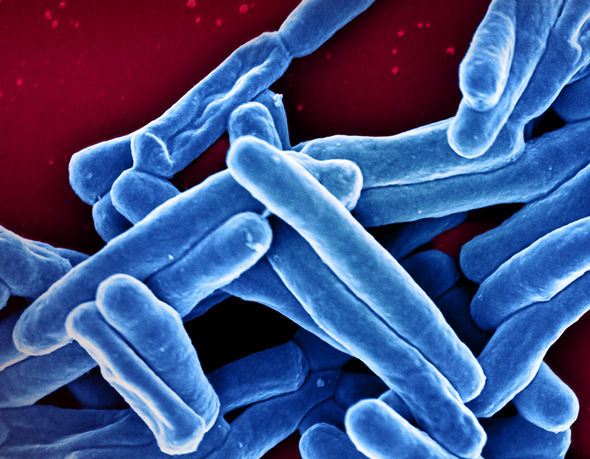 Scanning electron micrograph of Mycobacterium tuberculosis (colorized blue), the bacterium which causes TB.  Credit: NIAID
