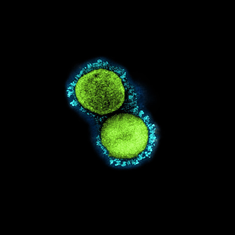 sars-cov-2 virus particles