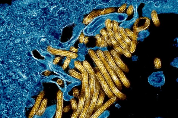 Microscopic view of gold, filament-shaped viruses clustered against a mass of blue tissue on a black background.  