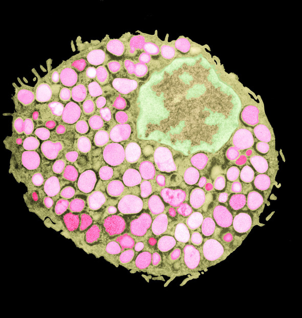 Irregular oval filled with many small pink circles and one large, green-and-beige amorphous shape.