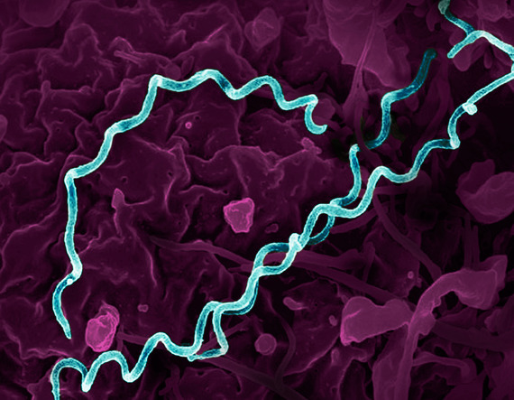 Several spiral-shaped bacteria highlighted in teal. 