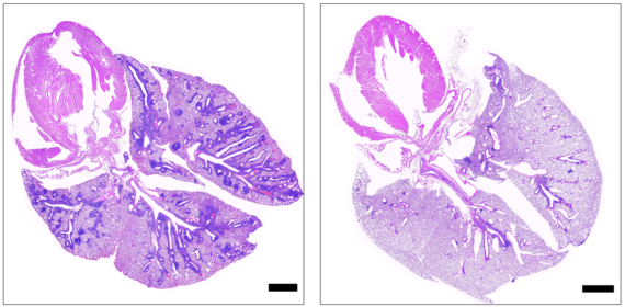 Two purple-speckled, lobe-shaped lung cross-sections in black-bordered white boxes, the left with several dark purple regions