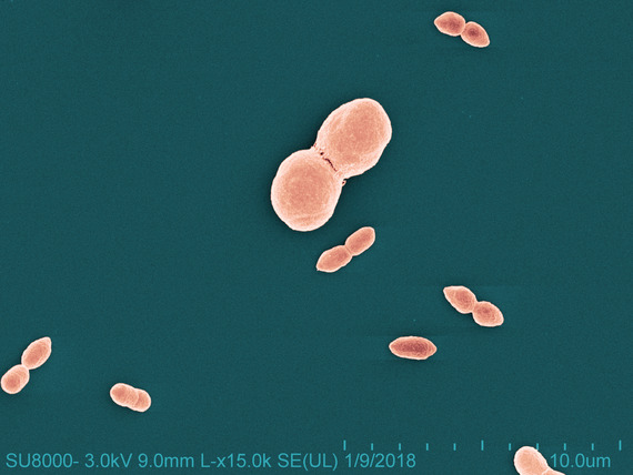 Short oval shaped bacteria of various sizes on a dark teal background. Each bacterium consists of two conjoined short ovals.