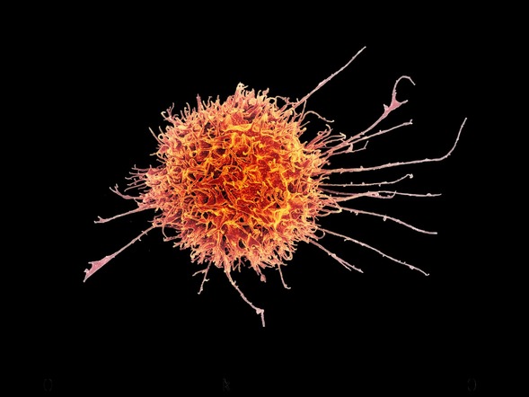 Close-up of a natural killer cell colored bright orange on a black background.