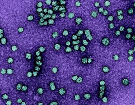 Microscopic image of dozens of teal-colored circular virus particles on a purple background