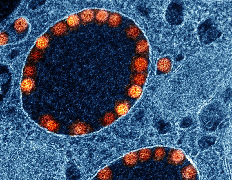 SARS-CoV-2 virus particles, which cause COVID-19.