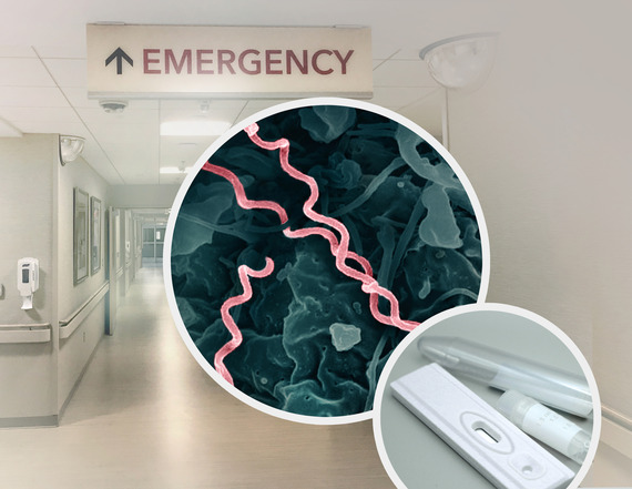 Emergency department sign with molecular syphilis image in circle overlay.