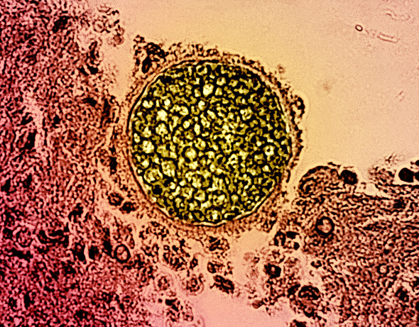 Valley fever particle