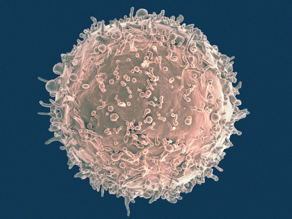 Microscopy of a pink spherical cell covered in many small, transparent appendages on a dark blue background