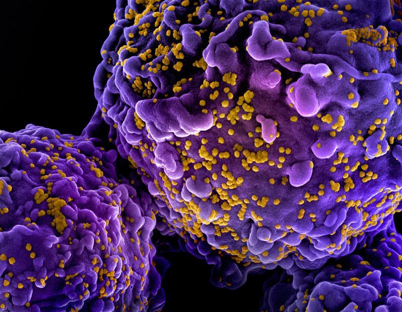 Purple and gold budding HIV virus particles