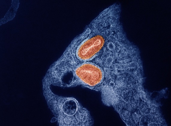 Two oblong shapes clustered close to each other within an irregular mass.