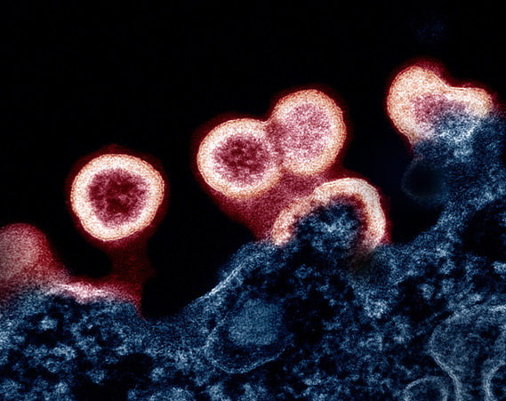 Round red virus particles with blue cell and black background.