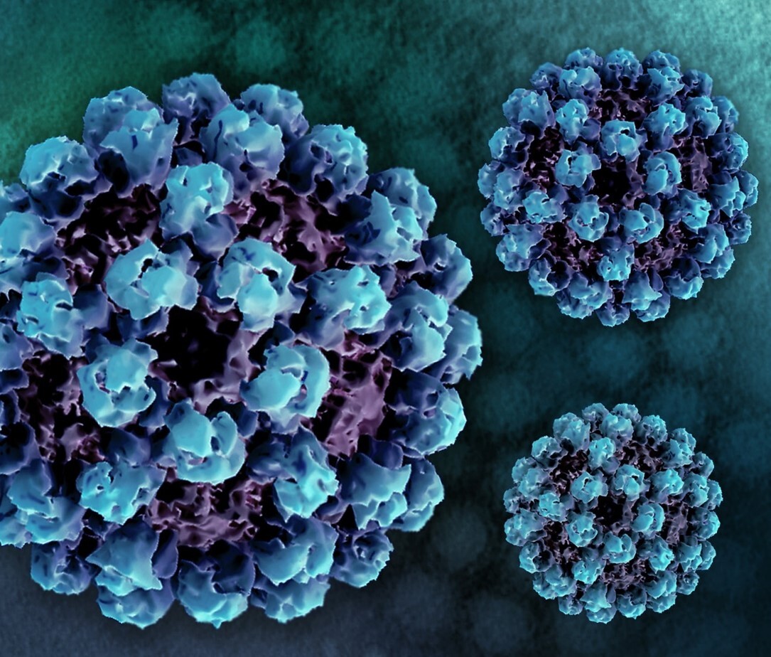 Norovirus Image