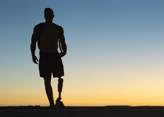 Man with lower-limb prosthetic