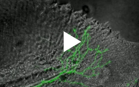 Regenerating Nerve Fibers Regenerating Nerve Fibers