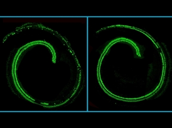 Confocal microscopy images of mouse cochlea
