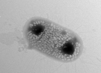 Transmission electron micrograph of a genetically engineered E. coli bacterium