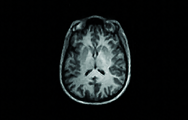 A brain image reconstructed from MRI data with AUTOMAP.