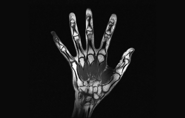 An MRI scan of a hand.