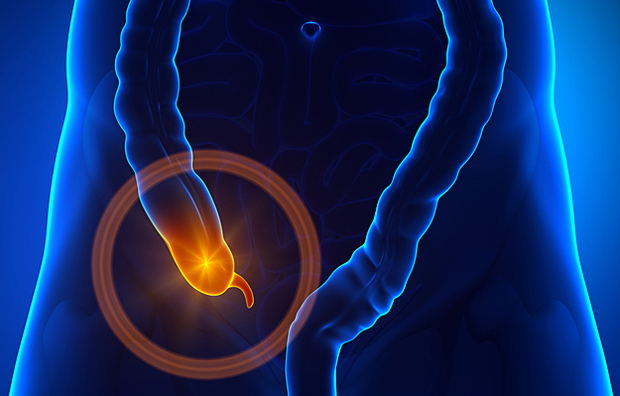 An illustration of the appendix.