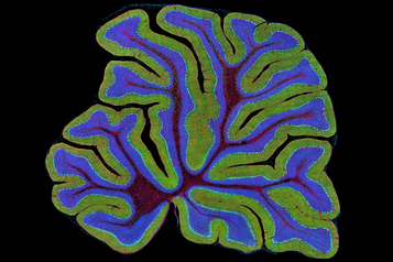 Mouse cerebellum