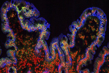 Human small intestine