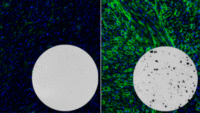 CRISPR-DMD