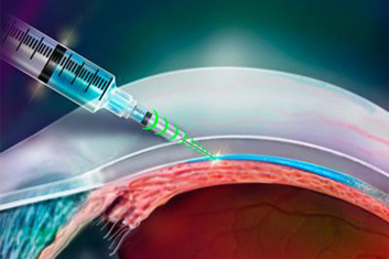 Resistance-sensing injector