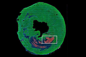 Mouse heart section