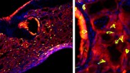Mouse Lungs Showing Tuft Cells