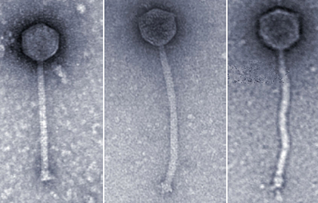 Electron micrographs of three bacteriophages.