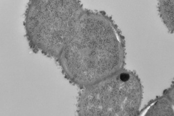 Electron micrograph of Ruminococcus gnavus