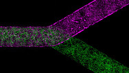 Blood-Brain Barrier