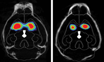 Dopamine transporter in mouse brain scans