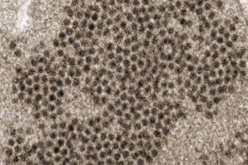 Electron microscope image of EV-D68 virions