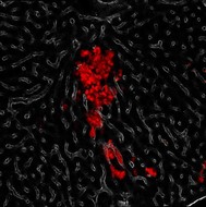 Small cell lung cancer cells (red) spreading via blood vessels (white) from the lung to the liver of a genetically-engineered mouse model. 