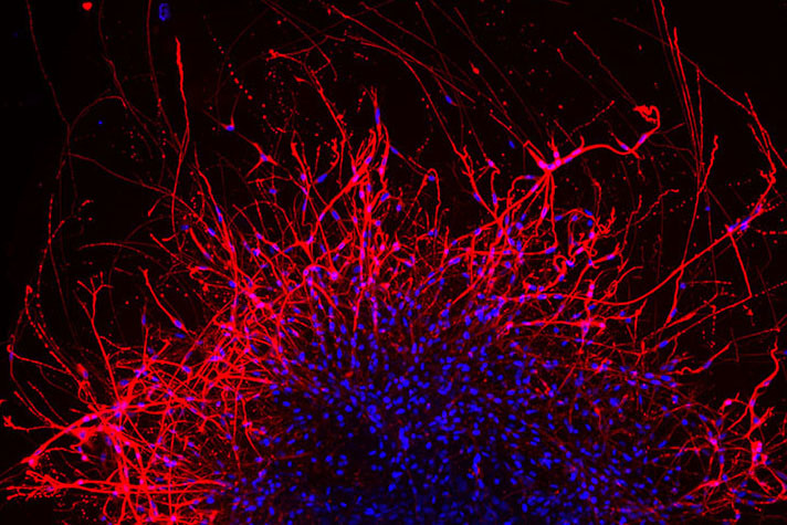 Neurons growing neurites
