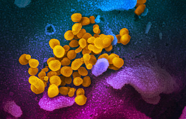A scanning electron microscope image showing SARS-CoV-2 (yellow)—also known as 2019-nCoV, the virus that causes COVID-19.