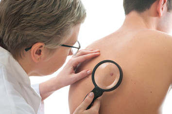 Dermatologist examining a mole on a person's back