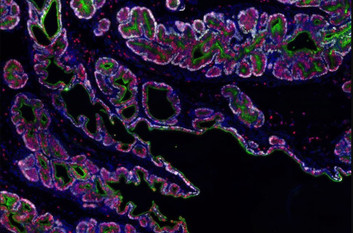 Fluorescent microscope image of mouse prostate