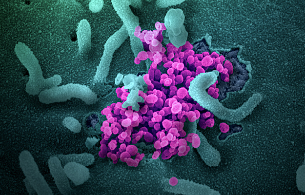 A micrograph of novel coronavirus SARS-CoV-2.