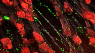 NETs ensnaring bacteria