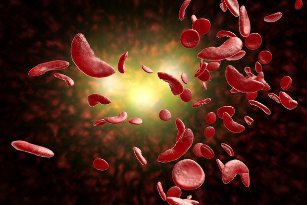 An illustration of sickled blood cells and healthy blood cells.